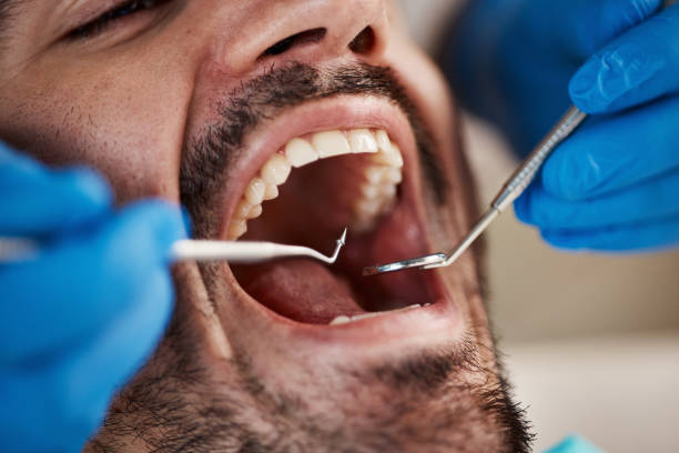 Best Emergency Dental Extractions in Bradford Woods, PA